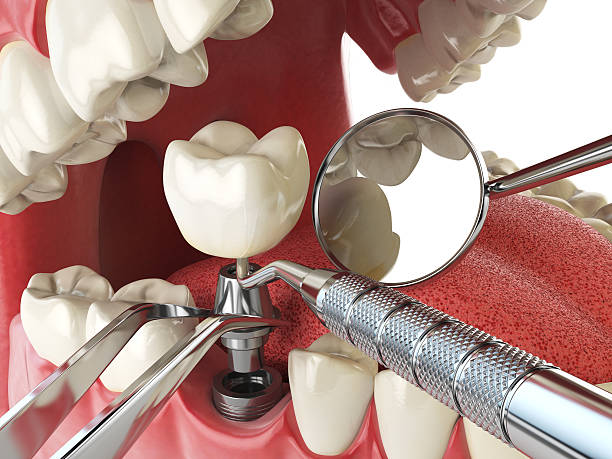 Best Emergency Gum Treatment in Valle Vista, AZ